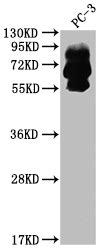 Anti Homo Sapiens Human PCSK9 Recombinant Monoclonal Antibody Cusabio