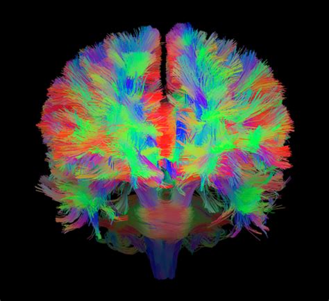 Introduction to dMRI