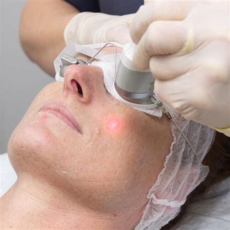 Affordable Skin Treatments Brisbane Skin Laser Clinics