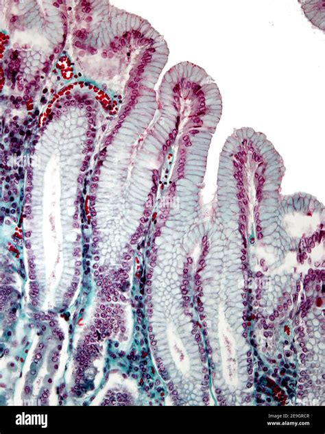 Gastric Mucosa Stained With The Masson Trichrome Stain The Surface