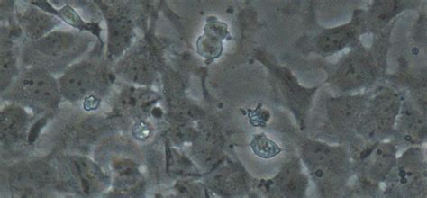Is Stem Cell Research Ethical