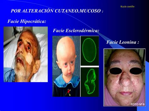 Facies Semiologia PPT