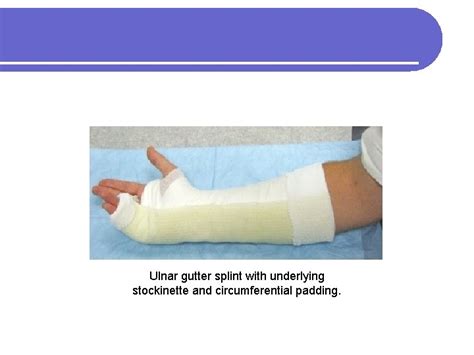 Plaster In Orthopaedics Principles Of Casting And Splinting