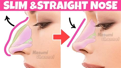 Get A Slim Straight Nose With This Exercise And Massage Hooked Nose Reduction Remove Nose Hump