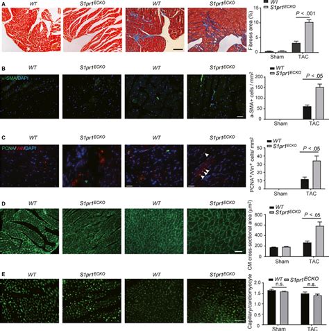 Endothelial S1pr1‐deficiency Aggravates Post‐tac Pathological Cardiac