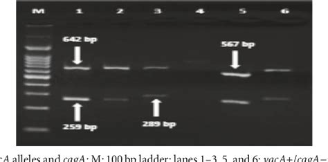 [pdf] Genotyping Of Helicobacter Pylori Virulence Genes Caga And Vaca