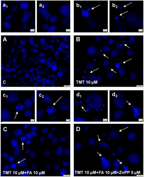 Ferulic Acid Neutralizes Tmt Induced Dna Fragmentation Through The