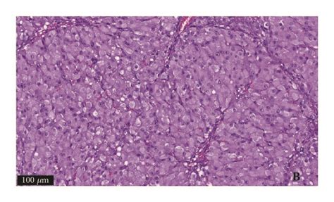 Hematoxylin And Eosin Staining Of The Surgical Specimen Download