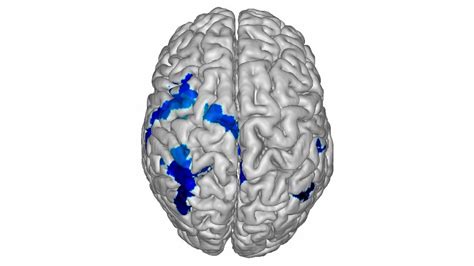 Producción No quiero hacer los deberes las 2 partes del cerebro