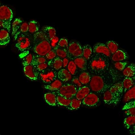 Hsp60 Heat Shock Protein 60 Mitochondrial Marker Antibody Clone