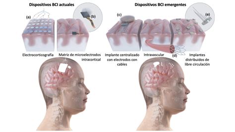 Las Interfaces Cerebro máquina un Capricho De Elon Musk O El Futuro