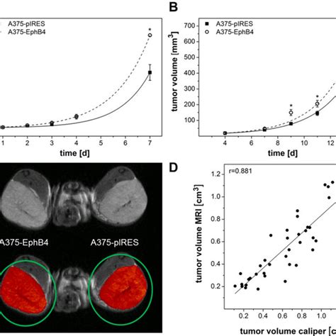 Overexpression Of Ephb4 In A375 Melanoma Cells Increases Cell Download Scientific Diagram