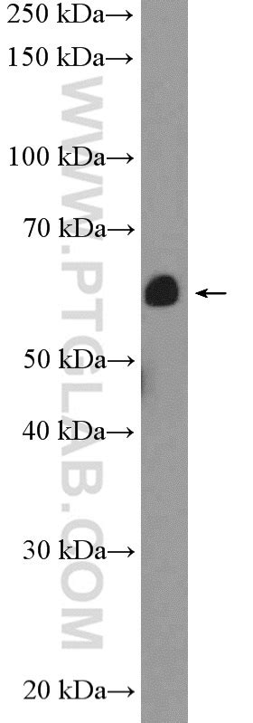 Calreticulin Antibody 10292 1 Ap Proteintech 武汉三鹰生物技术有限公司