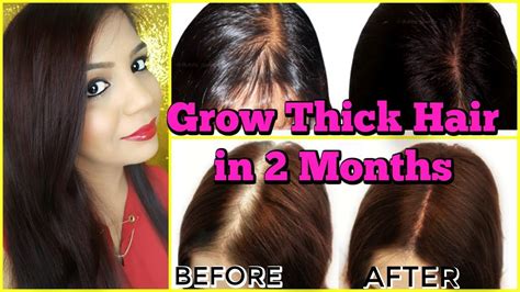 Fast Hair Growth Treatment Grow New Hair In 2 Months Superprincessjo Youtube