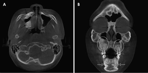 A An Axial Cone Beam Computed Tomography Cbct Image Shows Multiple