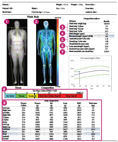 Dexa Scans Vision Health