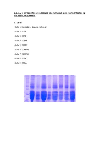 PRACTICA ELECTROFORESIS Pdf