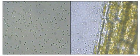 Microscopic View Of The Unicellular Cyanobacterium Synechocystis Sp