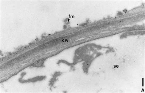 Tem Immunolocalisation Of The Agp Epitope Recognised By Lm2 On