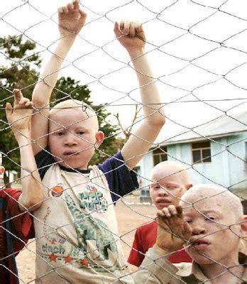 On the Spot: Albinos in Tanzania: Tanzania Albino Center in Moshi ...