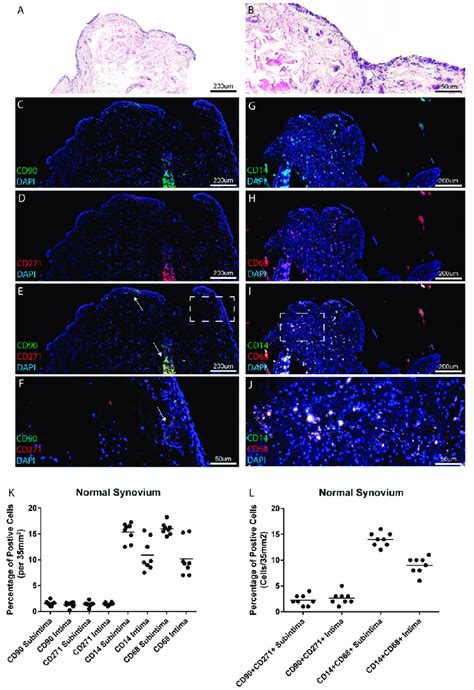 Mesenchymal Progenitor Cells Mpcs And Macrophages In Normal Synovium