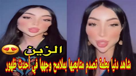 شاهد دنيا بطمة تصدم متابعيها بملامح وجهها في أحدث ظهور Youtube