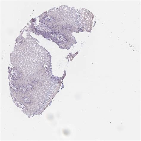 Tissue Expression Of Wfdc2 Staining In Vagina The Human Protein Atlas