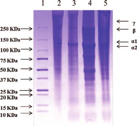 The SDS PAGE Patterns Of Gelatins Extracted From Poultry Heads Lane 1