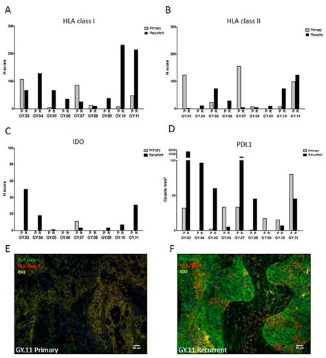 The Expression Of Immune Modulating Molecules On Tumor Cells In The Tme