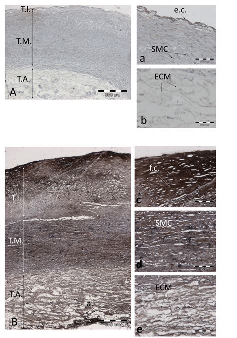 The Effect Of Von Kossa Staining In A Representative Aorta At A Low Download Scientific Diagram