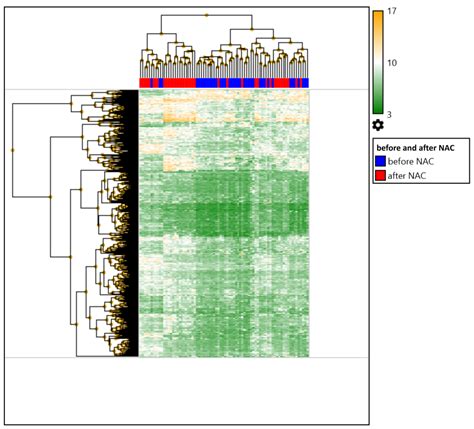 IJMS Free Full Text Whole Transcriptome Analysis Of Breast Cancer