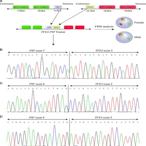 Psf Sfpq Is A Very Common Gene Fusion Partner In Tfe Rearra The