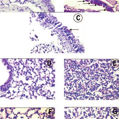 Light Micrograph Of The Lung Sections Of Mice Stained With PAS A B