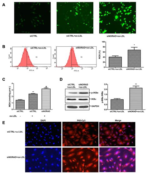 Downregulation Of Lncrna Norad Promotes Ox Ldl Induced Vascular