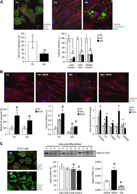 Expression Pattern And Subcellular Localization Of Tagln In