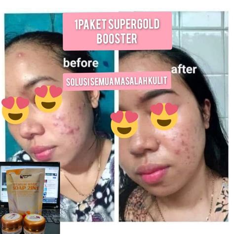 Jual Paket Booster In Khusus Untuk Kulit Susah Putih Shopee Indonesia