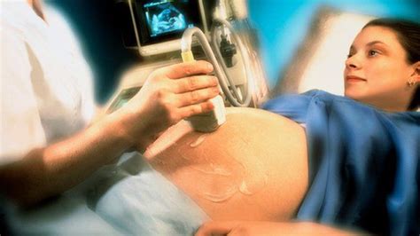 C Section Linked To Stillbirth Bbc News