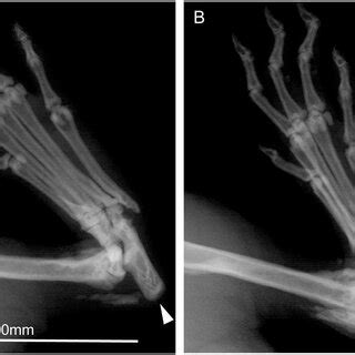 (a) X-ray image of the normal position of the calcaneus (arrow) within... | Download Scientific ...