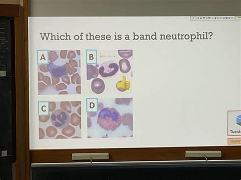 Clinical Haematology Task Review Flashcards Quizlet