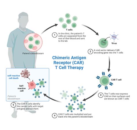 Car T Cells Therapy For Autoimmune Diseases