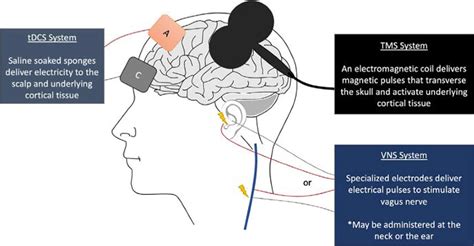 Figure 1 From From Adults To Pediatrics A Review Noninvasive Brain Stimulation Nibs To