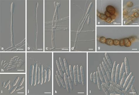 Ilyonectria Pseudodestructans All From Cbs 129081 Except G And E From