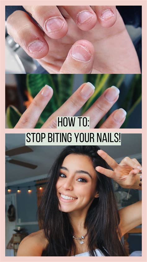 How To Stop Biting Your Nails For Good You Nailed It Nail Biting Remedies Nail Chewing