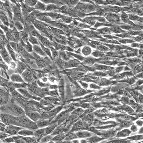 Green Fluorescent Human Dermal Fibroblasts Innoprot Fluorescent Cells