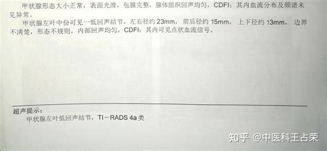 妙用名方逍遥散，疏肝健脾，软坚散结，可让甲状腺结节缩小，消失 知乎