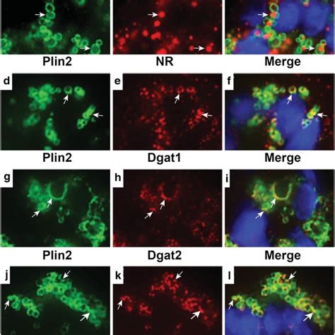 Localization Of Er Proteins And Lipid Droplets In Mammary Acini Of