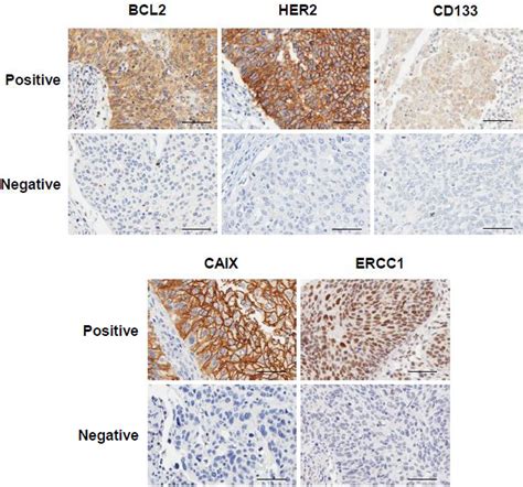 Frontiers Validation Of Potential Protein Markers Predicting