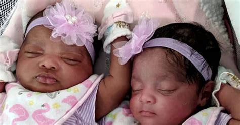 Woman gives birth to twins while in a coma due to coronavirus