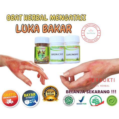 Jual OBAT LUKA BAKAR HERBAL MENGERINGKAN LUKA BAKAR SECARA ALAMI