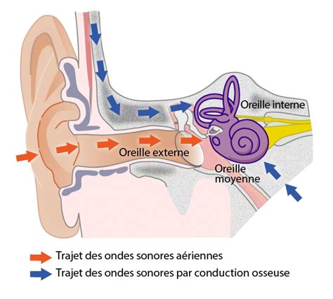 Conduction osseuse VS conduction aérienne quel casque choisir